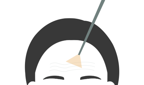 지방이식 STEP 02
